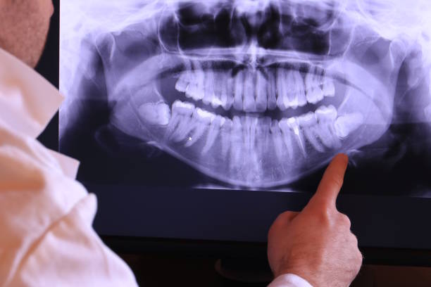 Best Pediatric Emergency Dentist in Clinton, MD
